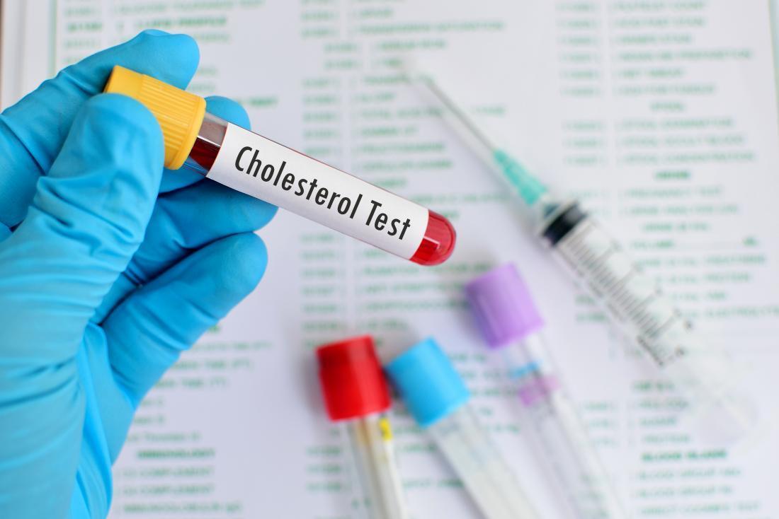 Chẩn đoán Cholesterol cao bằng xét nghiệm máu 